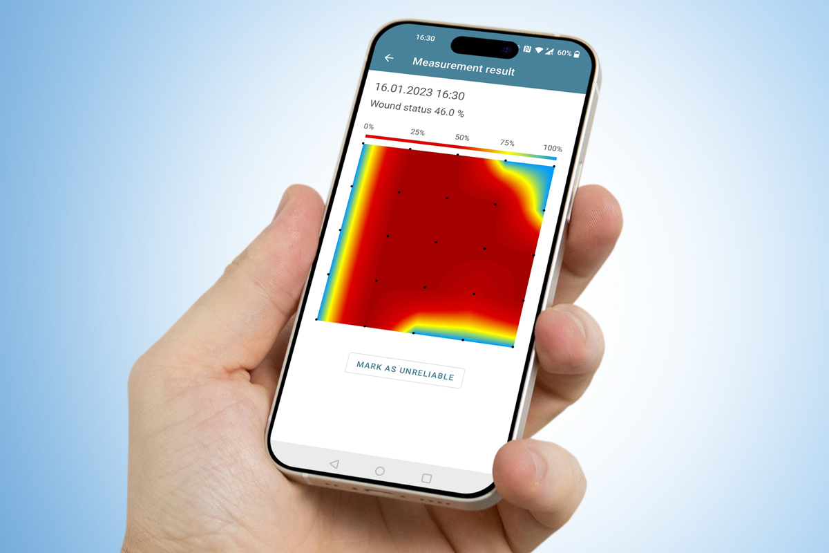 WoundWatch® mobile application